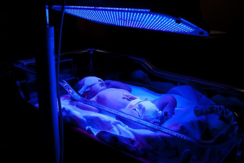 phototherapy